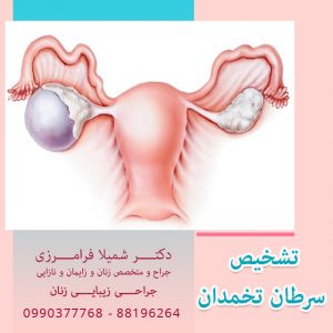 تشخیص سرطان تخمدان
