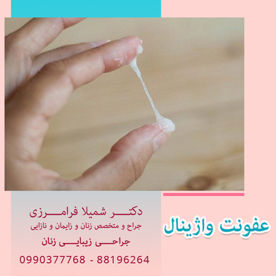 عفونت واژینال