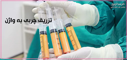 تریق چربی به لابیا ماژور چیست؟