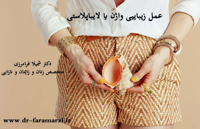 عمل زیبایی واژن یا لایباپلاستی