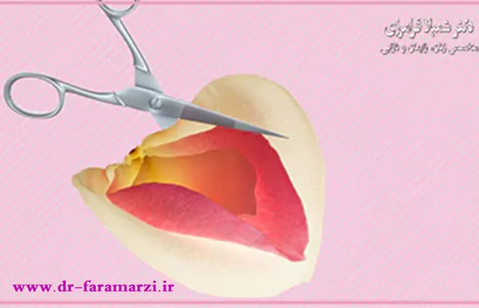 نحوه جراحی لایباپلاستی