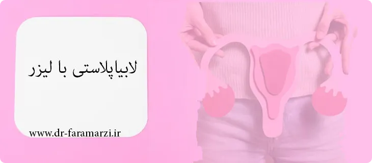 عمل لابیاپلاستی با لیزر